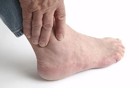 What is Gouty Arthritis?