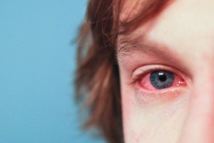 Common Forms of allergies suffering from people Forms of allergies