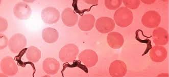 African trypanosomiasis commonly known as sleeping sickness