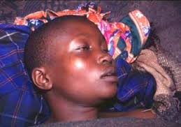 African trypanosomiasis commonly known as sleeping sickness