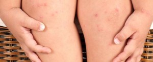 7 reasons to have itchy skin