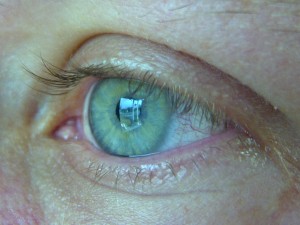 Health risks of contact lenses