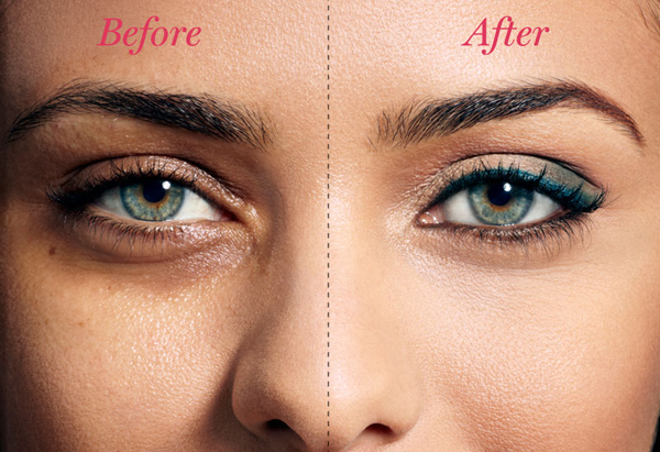 Beauty Tips : Home Remedies for Deep Sunken Eyes