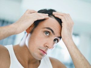 How can men cover baldness