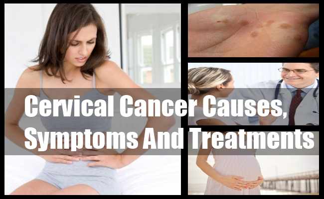 8 symptoms of cervical cancer