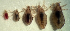 Home Remedies for Hair Lice Home remedies for hair lice