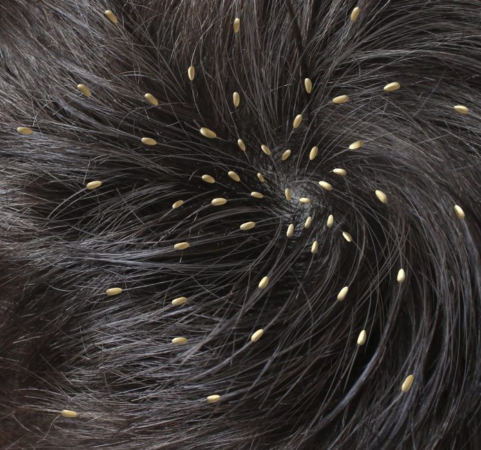 Home remedies for hair lice