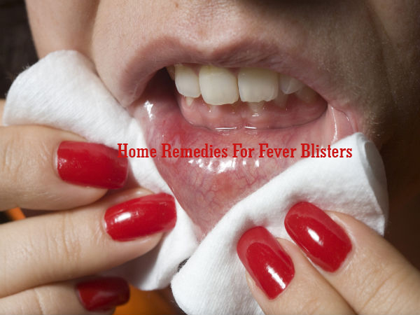 7 Home Remedies For Fever Blisters