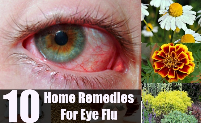 home remedies for eye flu