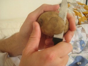 Heal Your Skin With Potato