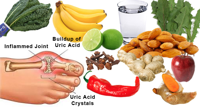 Symptoms, Treatments and Diet Chart for High Uric Acid Condition