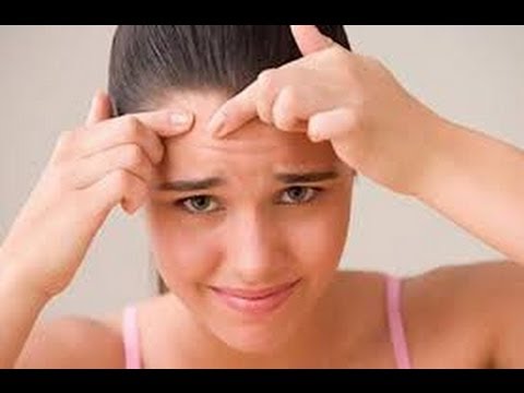 7 Best home remedies to treat forehead acne
