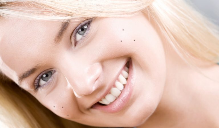 How to Remove Dark Spots