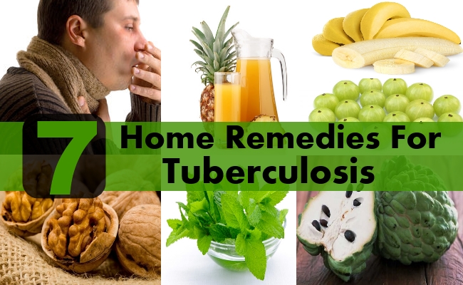 Home remedies to get rid of tuberculosis