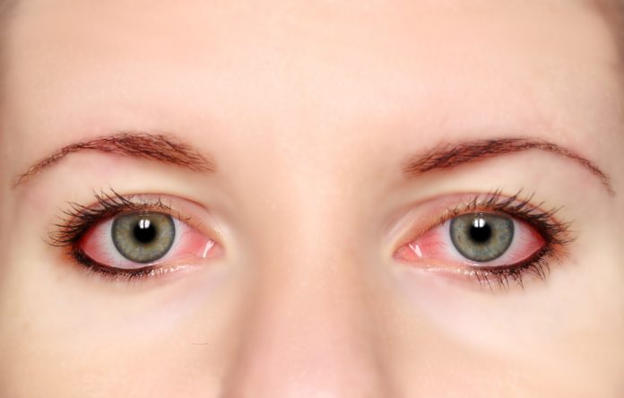 natural ways to soothe tired eyes