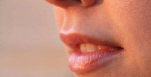 get rid white spots lips 1 300x153 - How to Get Rid of Fordyce Spots on Lips
