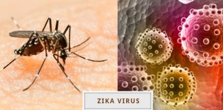 Zikka Virus Infection