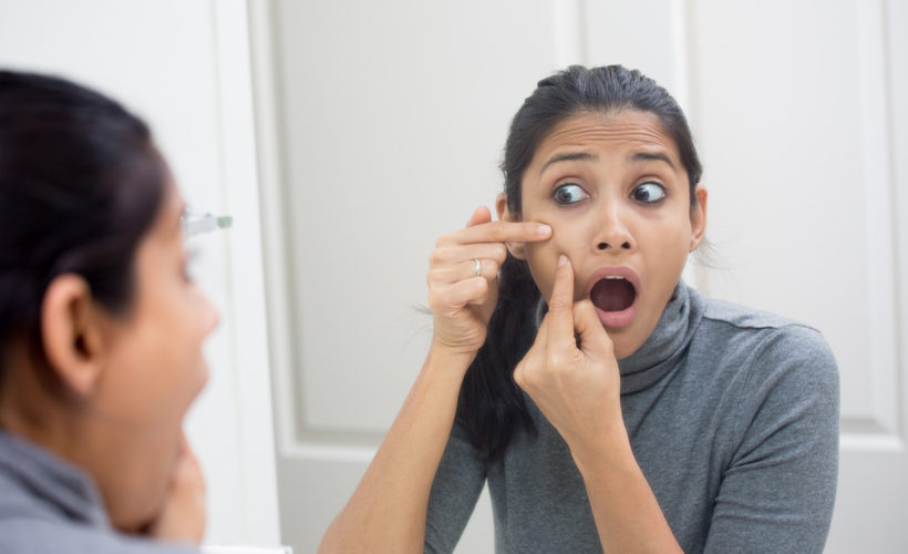 How to get rid of white facial hair permanently