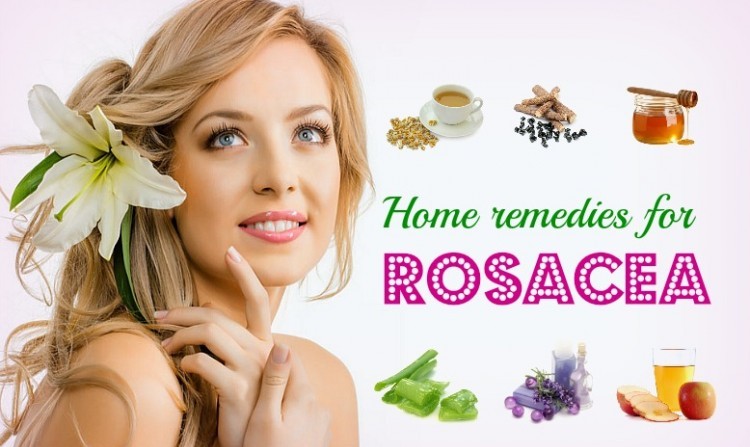 10 Best natural home remedies for rosacea