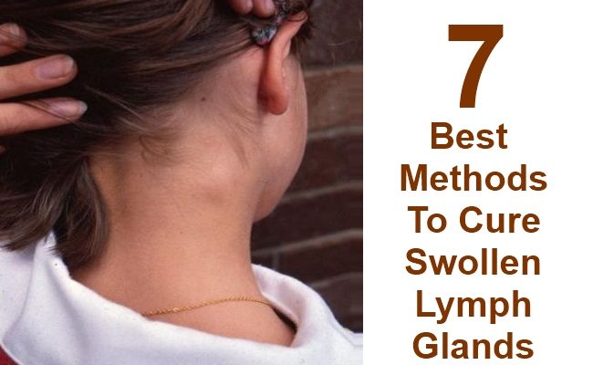 7 Ways To Cure Swollen Lymph Glands Yabibo