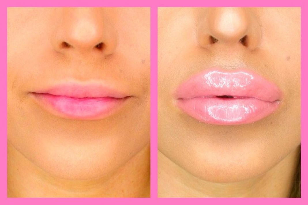 Five Ways To Make Lips Plumper Yabibo