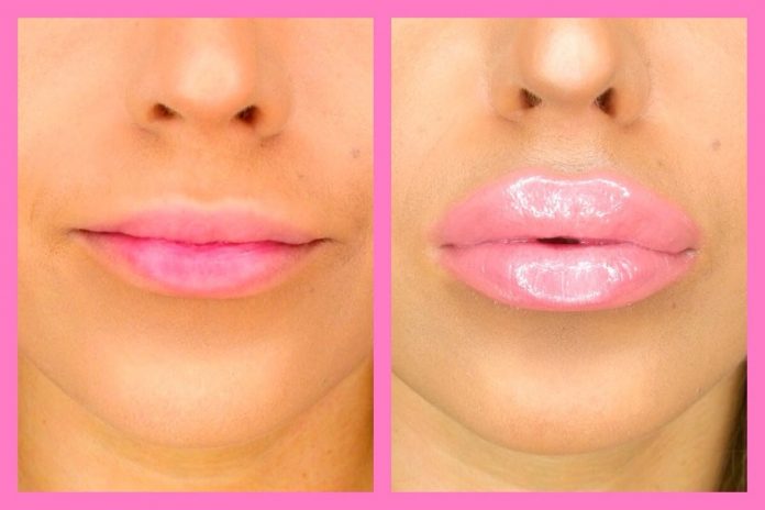 Five Ways To Make Lips Plumper