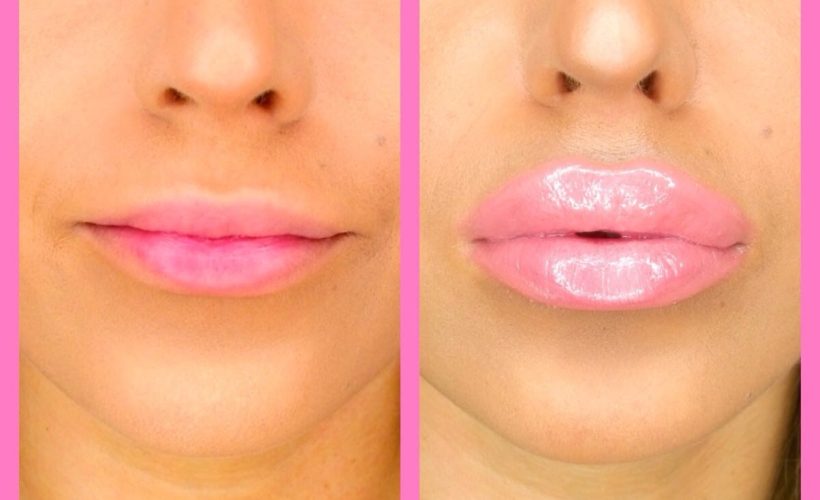 Five Ways To Make Lips Plumper