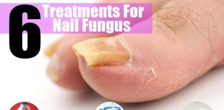 Home Remedies For Nail Fungus