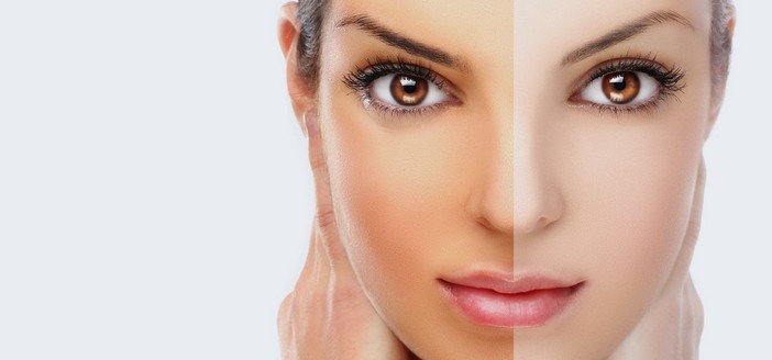 What are the Natural Beauty Tips for Fairness?
