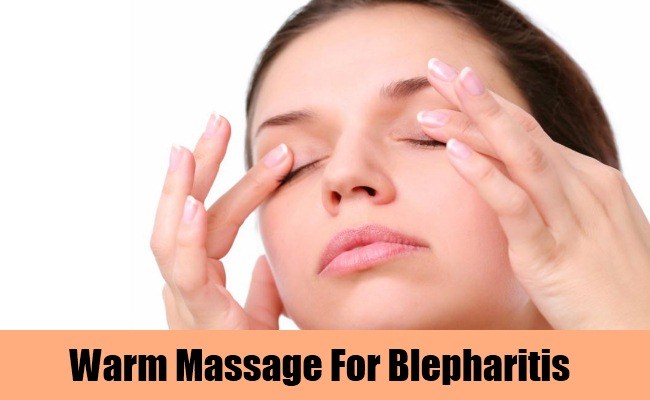 herbal remedies for blepharitis