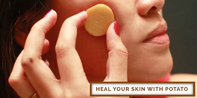 Heal Your Skin With Potato