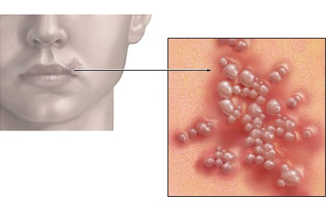 different types of skin diseases