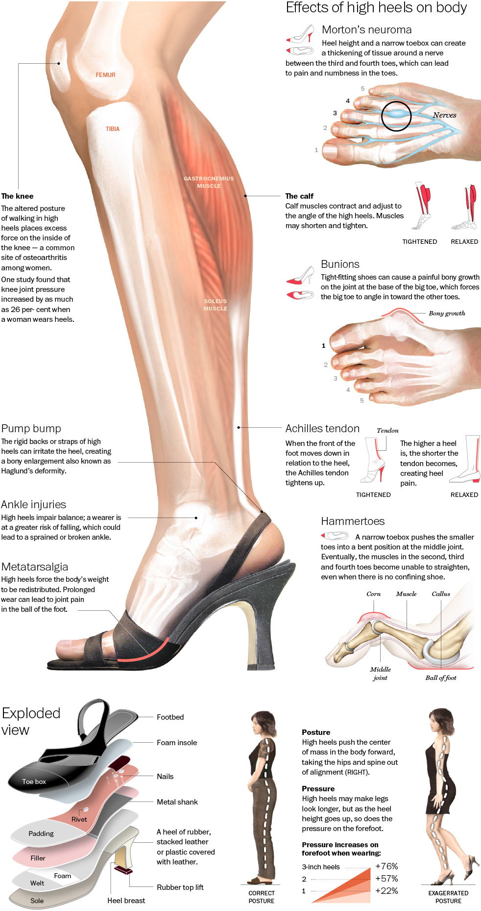 Effects Of High Heels On Body,High Heels