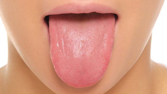 cut on tongue