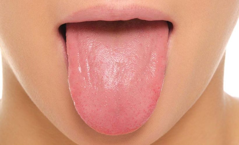 cut on tongue