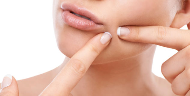 Things You Should Know Before You Pop a Pimple