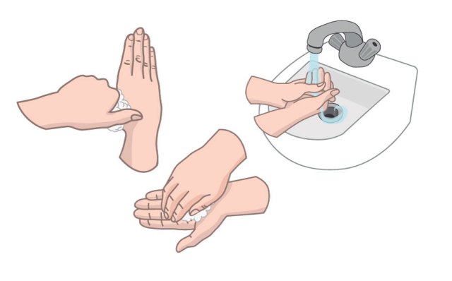 Reasons to Avoid Use of Hand Sanitizers