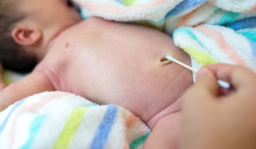How to Treat Belly Button Infection