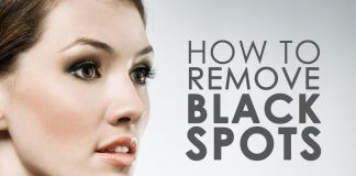 How to get rid of brown spots on the skin