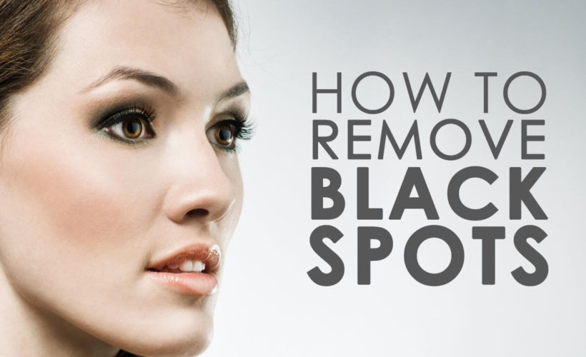 How to get rid of brown spots on the skin