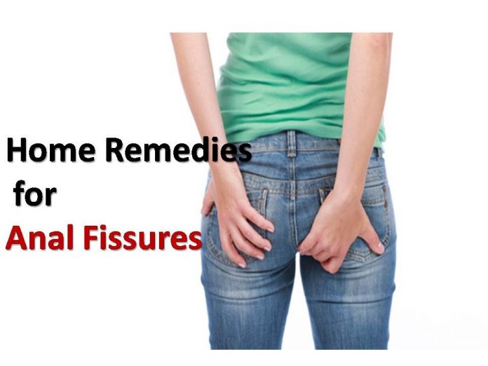 Home Remedies for Anal Fissures