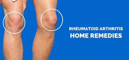 Home Remedies for Rheumatoid Arthritis