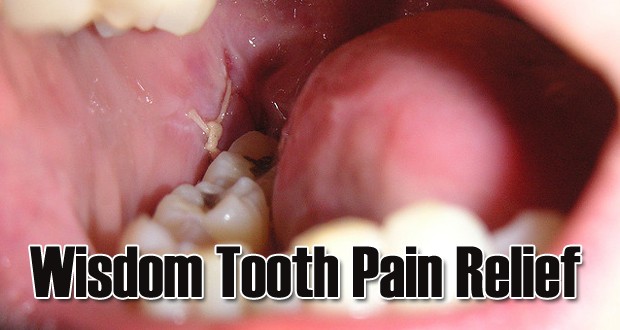 Home Remedies To Get Wisdom Teeth Pain Relief