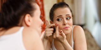 5 Ways To Control Comedonal Acne