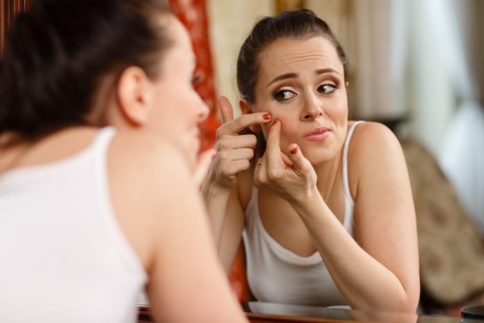 5 Ways To Control Comedonal Acne