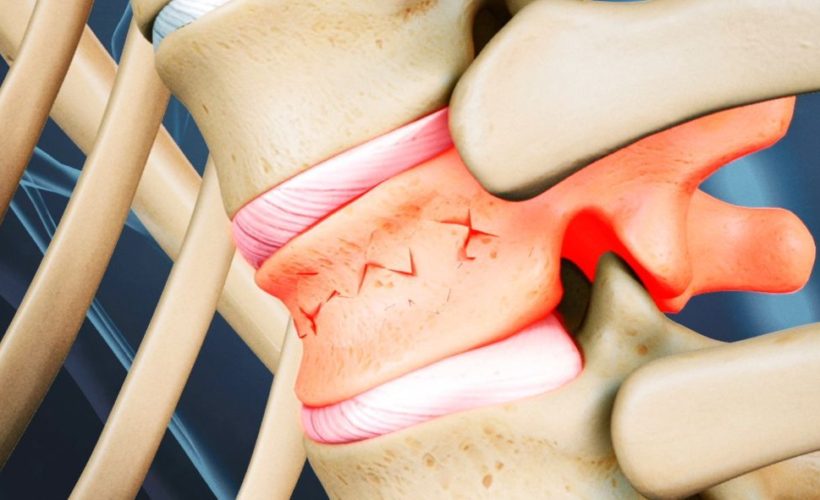Daily Activities That Can Damage Your Spine