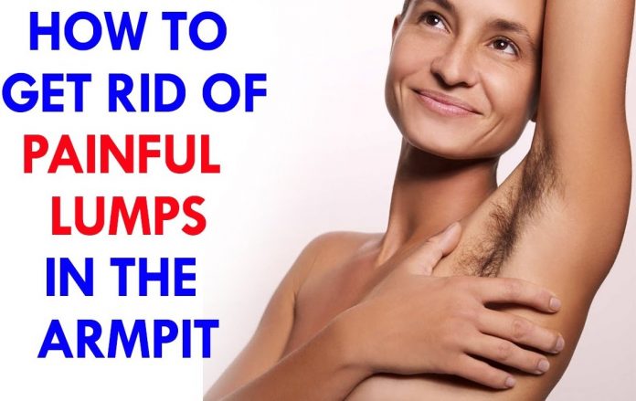 Home remedies To Get Rid Of Painful Lumps In The Armpit