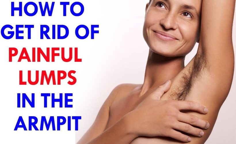 Home remedies To Get Rid Of Painful Lumps In The Armpit