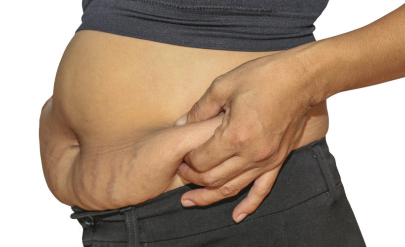 Home Remedies to Get Rid of Loose Skin after Pregnancy