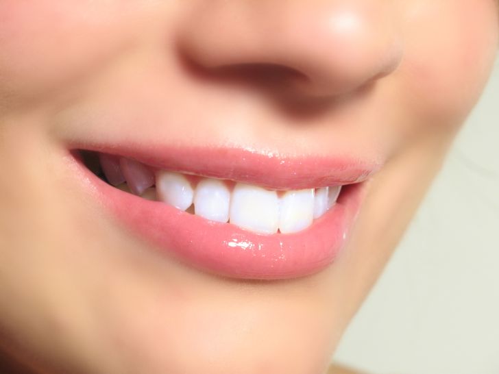 How to Get Rid Of  White Spots from Your Teeth